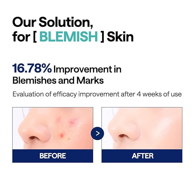 Mediheal Vita Collagen Under Eye Patches & Madecassoside Blemish Toner Pad for Daily Blemish Care