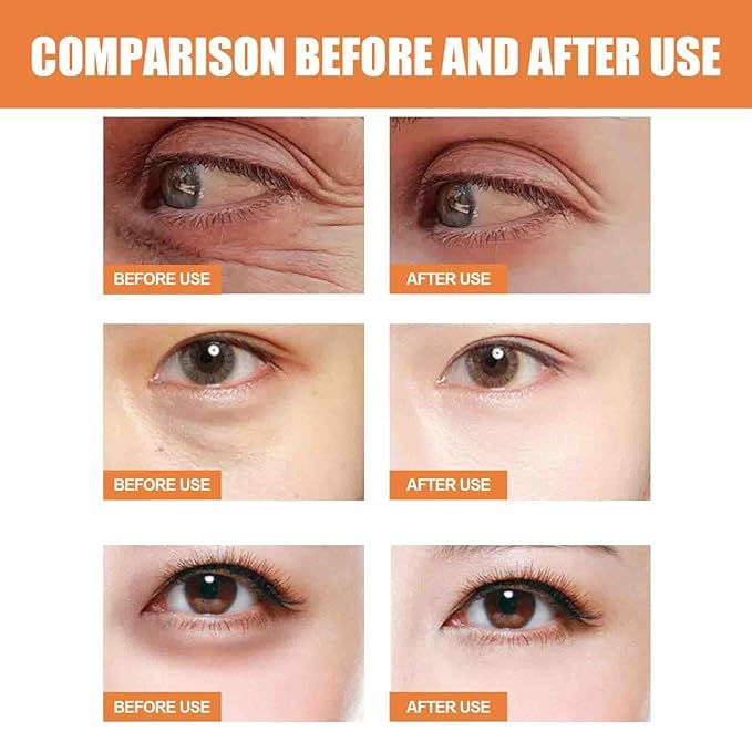 3pcs Revive + Glow Vitamin C Eye Balm, Revive and Glow Vitamin C Eye Balm, Hydrating Eyes Cream, Improve Dark Circles, Reduces Puffiness, Evens out skin tone (3)