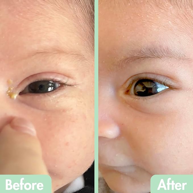 GlamBaby Eye Boogies Stye Eye Treatment | Sting-Free & Wipe-Free | Hypochlorous Eyelid Cleanser & Pink Eye Drops | Provides Allergy Conjunctivitis & Blepharitis Relief | Baby Eye Drops Spray (2 Pack)