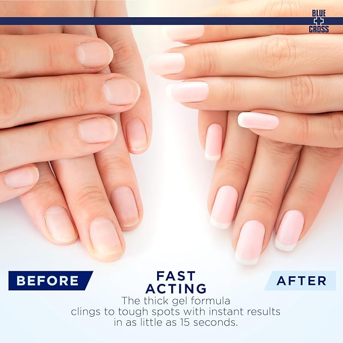 Blue Cross Professional Nail + Cuticle Care Optical Nail Brightening Basecoat Nail Concealer + Cuticle Remover Softener Gel in Eucalyptus/Tea Tree Scent, 2 Pack Bundle