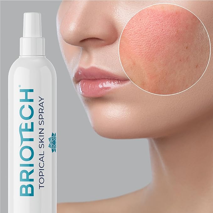 BRIOTECH Topical Skin Spray, Hypochlorous Acid Spray for Body & Face, Eyelid Cleanser, HOCl Facial Mist, Support Against Irritation and Redness, Packaging May Vary, 4 oz, 1 ct