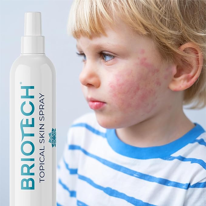 BRIOTECH Topical Skin Spray, Hypochlorous Acid Spray for Body & Face, Eyelid Cleanser, HOCl Facial Mist, Support Against Irritation and Redness, Packaging May Vary, 4 oz, 1 ct