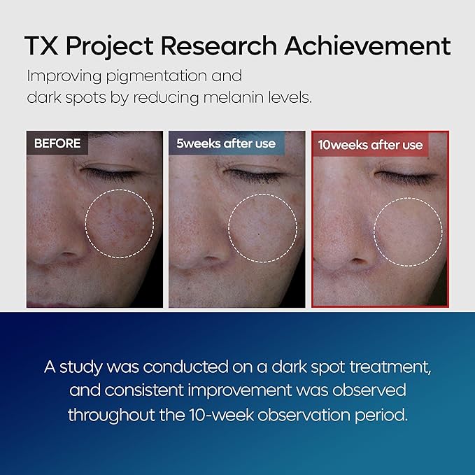 TX Tranexamic Acid Care Line TX cream+Toner+Ampoule+Cleanser Powerful Dark Spot Care | Visible Improvement in 4-8 Weeks