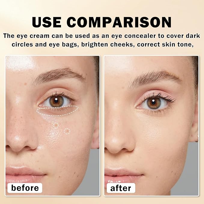 Mineral Sunscreen Eye Cream,3-in-1 Under Eye Cream,for Puffiness and Bags Under Eyes,Dark Circle and Wrinkles,Anti Aging,Under Eye Brightener and Concealer,SPF 35 (Light)