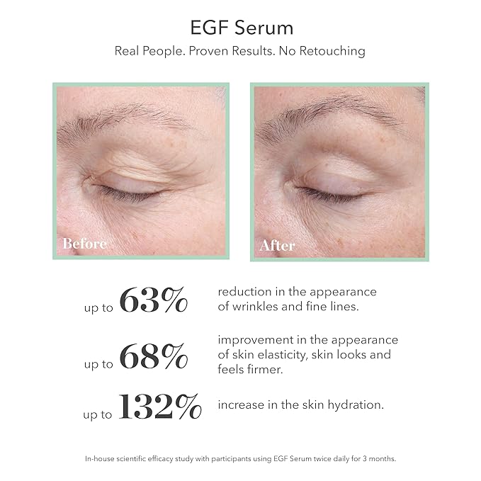 BIOEFFECT EGF Serum, Eye Serum, Eye Mask Skincare Set: Firming Favorites, with Barley Growth Factor