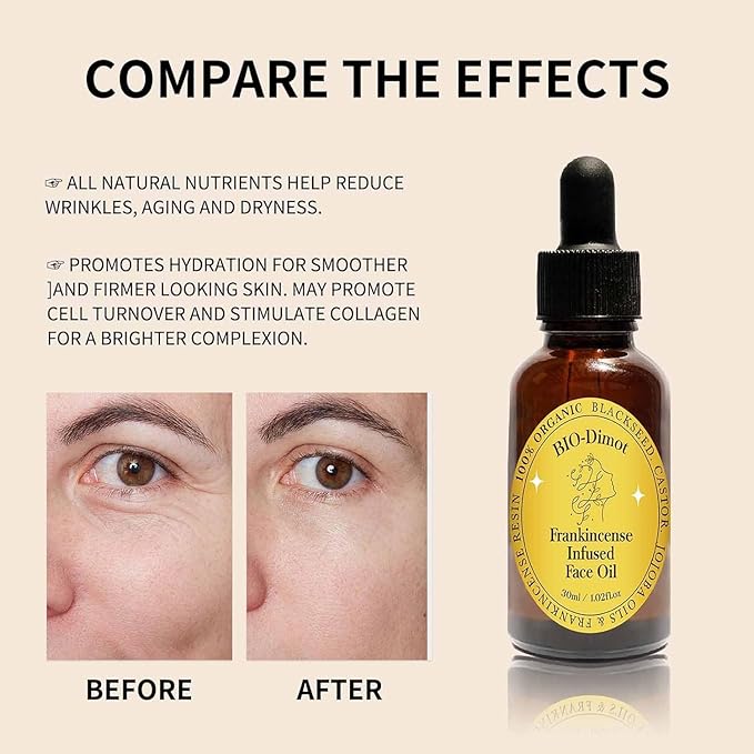 Frankincense Resin Oil For Face,Frankincense Resin Infused Organic Black Seed & Jojoba Oils,Natural skin Care moisturizing, Facial Anti-Aging Moisturizing skin Serum (1)
