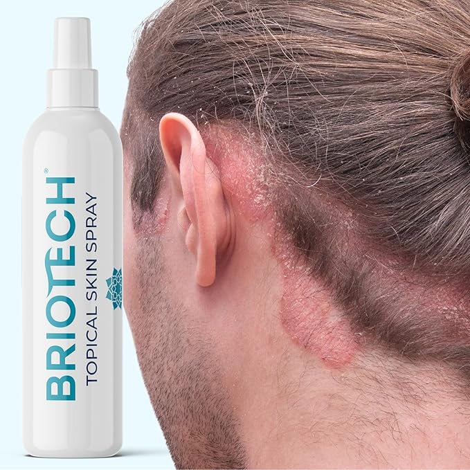 BRIOTECH Topical Skin Spray, Hypochlorous Acid Spray for Body & Face, Eyelid Cleanser, HOCl Facial Mist, Support Against Irritation and Redness, Packaging May Vary, 4 oz, 1 ct