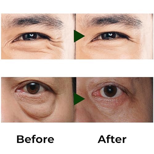 Combo exclusively for men Abera Eye Roller Serum With Mint Essence - Abera Armpit Roller