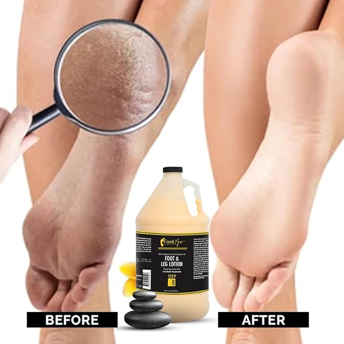 Foot SPA - Healing Therapy Massage Lotion,128 Oz - with Peppermint and Eucalyptus - Professional Pedicure, Body and Hot Oil Manicure, Infused with Natural Oils and Vitamins - Bulk, Refill Gallon