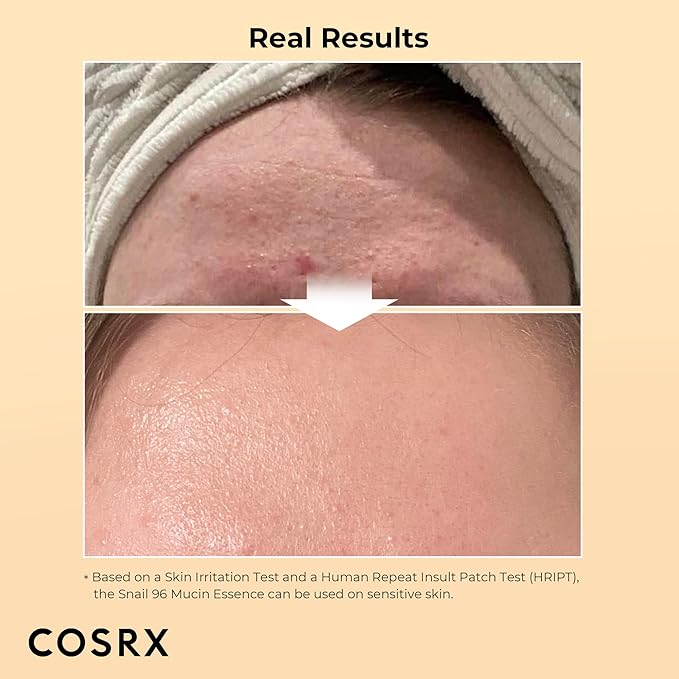 COSRX Best Seller Duo- Snail 92 Cream & Snail 96 Essence, Daily Face Gel Moisturizer and Hydrating Serum for Face with Snail Secretion Filtrate, Korean Skin Care