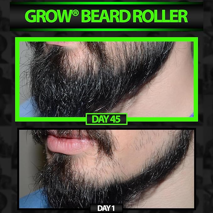 GROW Beard Roller Beard Growth Kit - Best Beard Kit Set of 2 Hair Follicle Stimulator Rollers - The Ultimate Beard Roller for Hair Growth Men of All Skin Types Can Use as a Follicle Booster by BBS USA